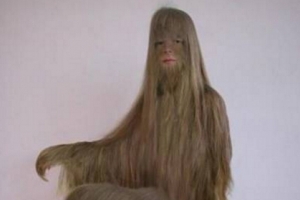 世界上体毛最长的女人，艾米丽·苏珊（如同猿人）