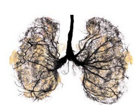 五大肺癌早期前兆,杀死萌芽时期的癌症