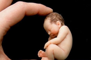 世界上最早产的婴儿 母亲怀孕仅6个月
