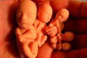世界十大堕胎率最高地区，堕胎超过分娩数量