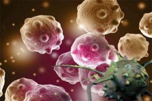 会传染的10种癌症：宫颈癌上榜，家族遗传病史高